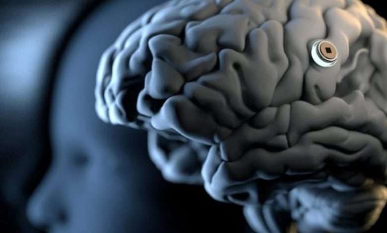 "نيورالينك" تبحث عن متطوعين لتجربة شريحتها الدماغية.. هل أنت مستعد!؟