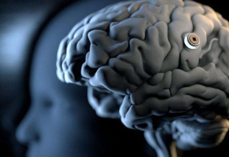 "نيورالينك" تبحث عن متطوعين لتجربة شريحتها الدماغية.. هل أنت مستعد!؟