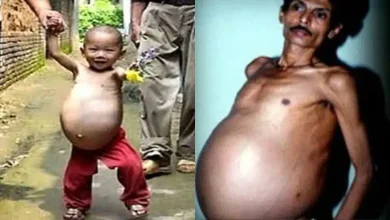 شاب هندي عاش حياته تعيسا… ما علاقة توأمه؟