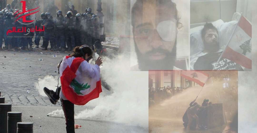 بعد أن اقتُلعت عيونهم قمعاً لحريتهم… دولة العصابات تتملص من مسؤوليتها "وكأن شيئا لم يكن"