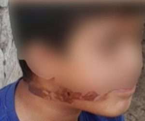 بالصور: عنّـ. ـف أطفاله بوحشية والمعلومات تتحرك 