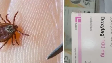 حشرة تتسبب بوفـ. ـاة فتاة أردنية