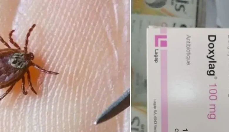 حشرة تتسبب بوفـ. ـاة فتاة أردنية