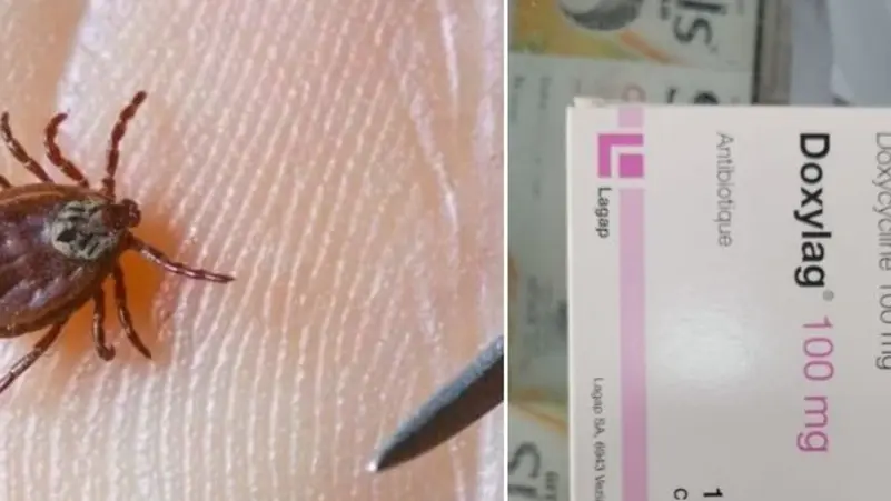 حشرة تتسبب بوفـ. ـاة فتاة أردنية