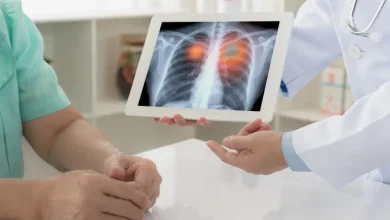 علماء كنديون يكتشفون طريقة بسيطة للكشف المبكر عن سرطان الرئة