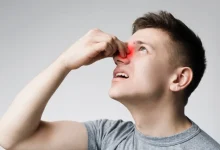 ‫هكذا يمكنك إيقاف نزيف الأنف بسرعة