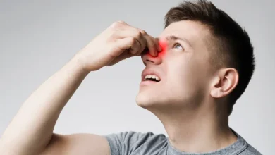 ‫هكذا يمكنك إيقاف نزيف الأنف بسرعة