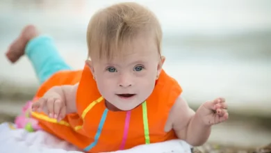 الكشف عن جينات مسؤولة عن حدوث عيوب القلب لدى مرضى متلازمة داون