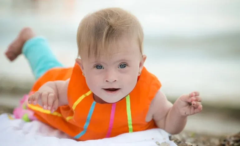 الكشف عن جينات مسؤولة عن حدوث عيوب القلب لدى مرضى متلازمة داون