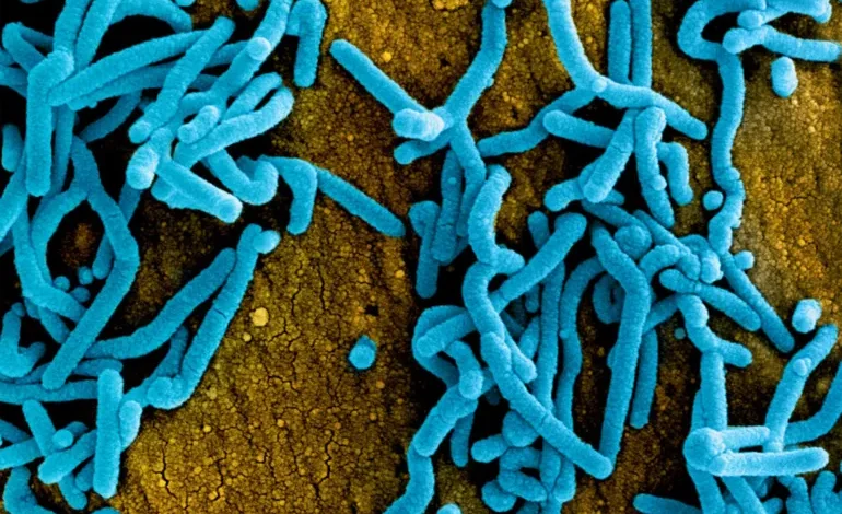 ارتفاع الوفيات جراء فيروس‭ ‬ماربورغ إلى 6