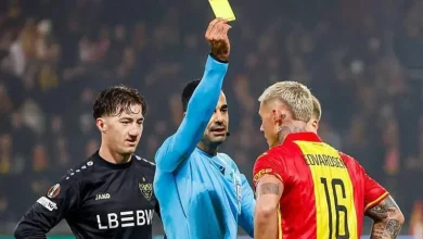 ستيلر.. مريض قولون يعاني من "الشفة الأرنبية"