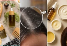 القضاء على قشرة الشعر ممكن بأساليب طبيعية وعمليّة