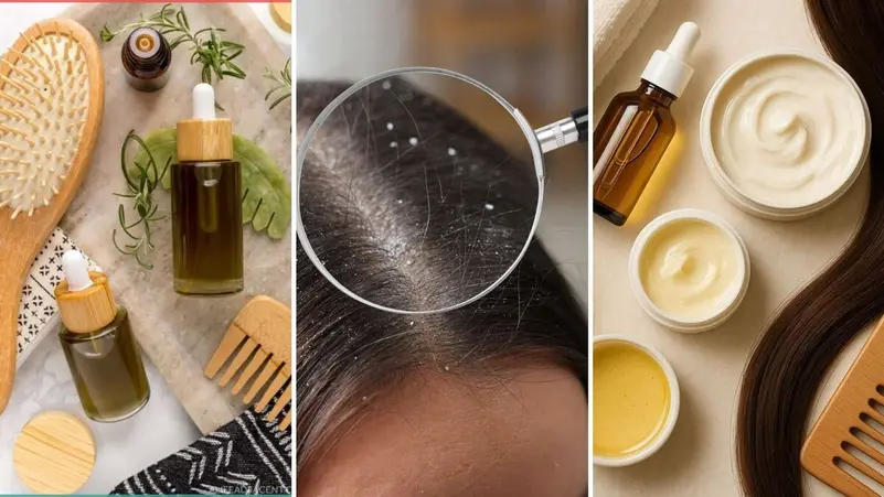 القضاء على قشرة الشعر ممكن بأساليب طبيعية وعمليّة