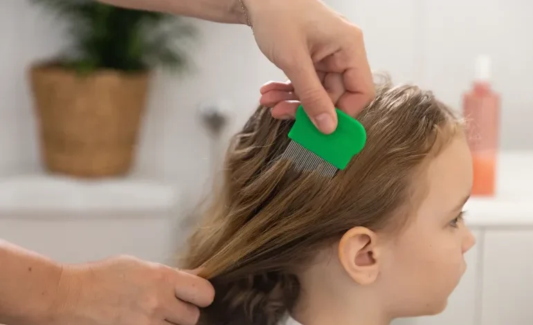 3 خطوات للتخلص من القمل