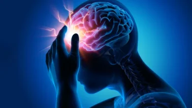 ‫ماذا تفعل إذا شهدت نوبة صرع؟