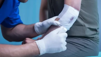 ابتكار كوري طبي لوقف النزيف في لحظات