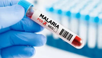 أقمشة معالجة تقلل إصابة الرضع بالملاريا