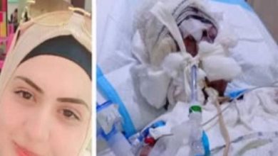 أحرق زوجته بالزيت ورماها… و”الأمن” بالمرصاد!