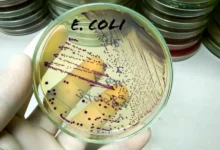 هل تقتل المضادات الحيوية البكتيريا؟ .. الإجابة صادمة