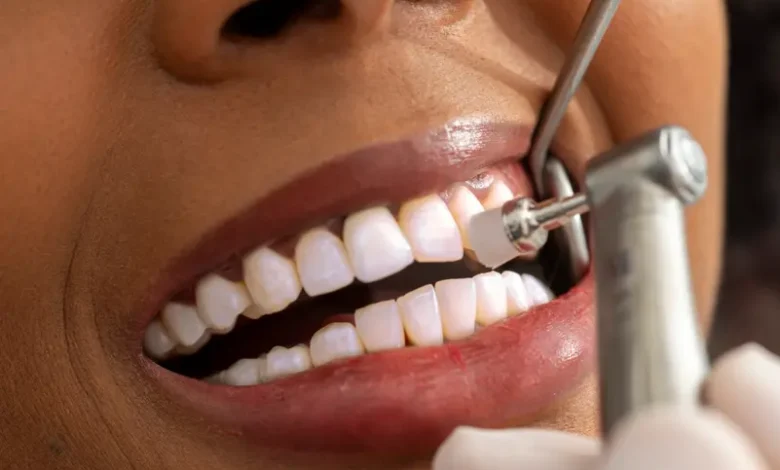 ابتكار جديد لوقاية الأسنان من التسوس