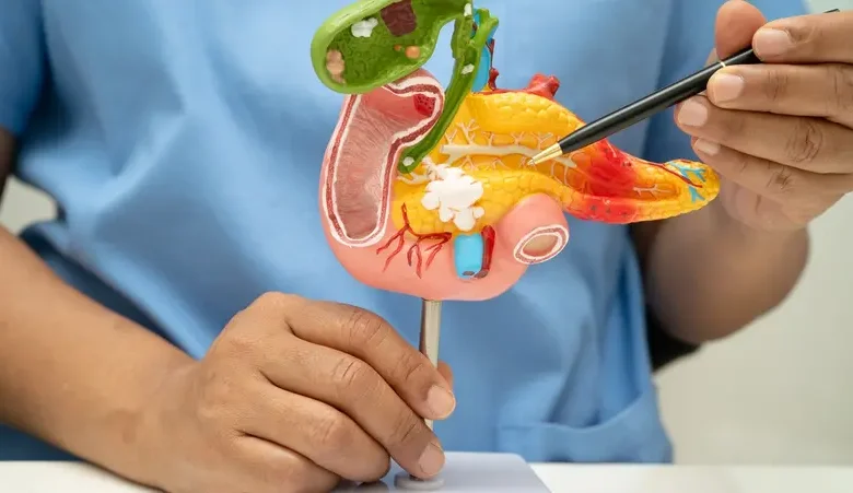 إنجاز إسباني يفتح باب الأمل لعلاج سرطان البنكرياس