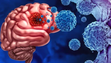 ما هي اعراض تورم الدماغ؟