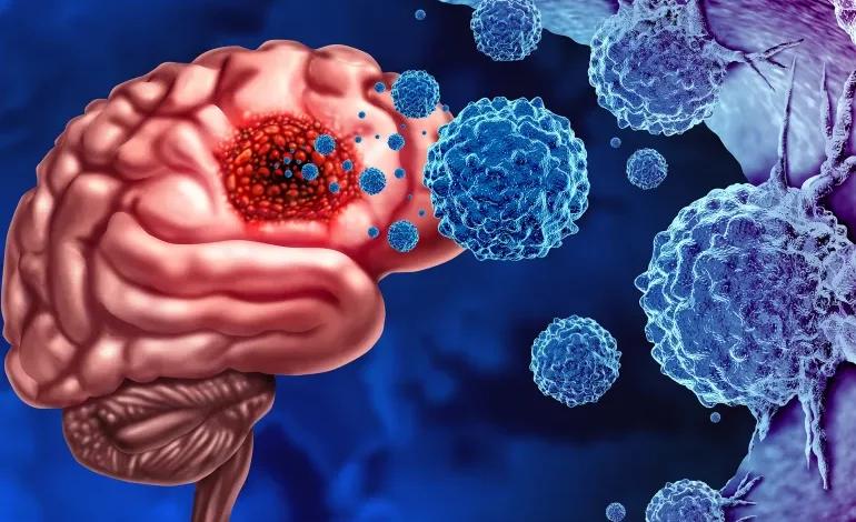 ما هي اعراض تورم الدماغ؟