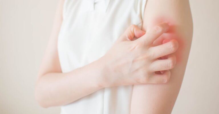 عدوى جديدة تثير المخاوف… والقلق ظهرت في لبنان