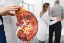 هل يستطيع مريض الكلى الصيام؟