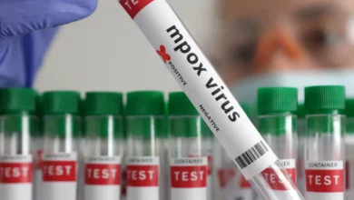 منظمة الصحة العالمية تحذر من سلالات "mpox" المؤتلفة